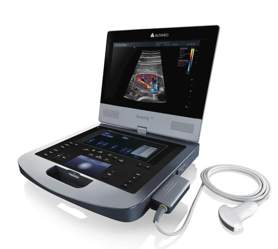 Leve e compacto, com alça de transporte e excelente qualidade de imagem o INVICTUS L5 se torna a solução ideal para exames de cardiologia básica à avançada e também auxiliar procedimentos guiados.