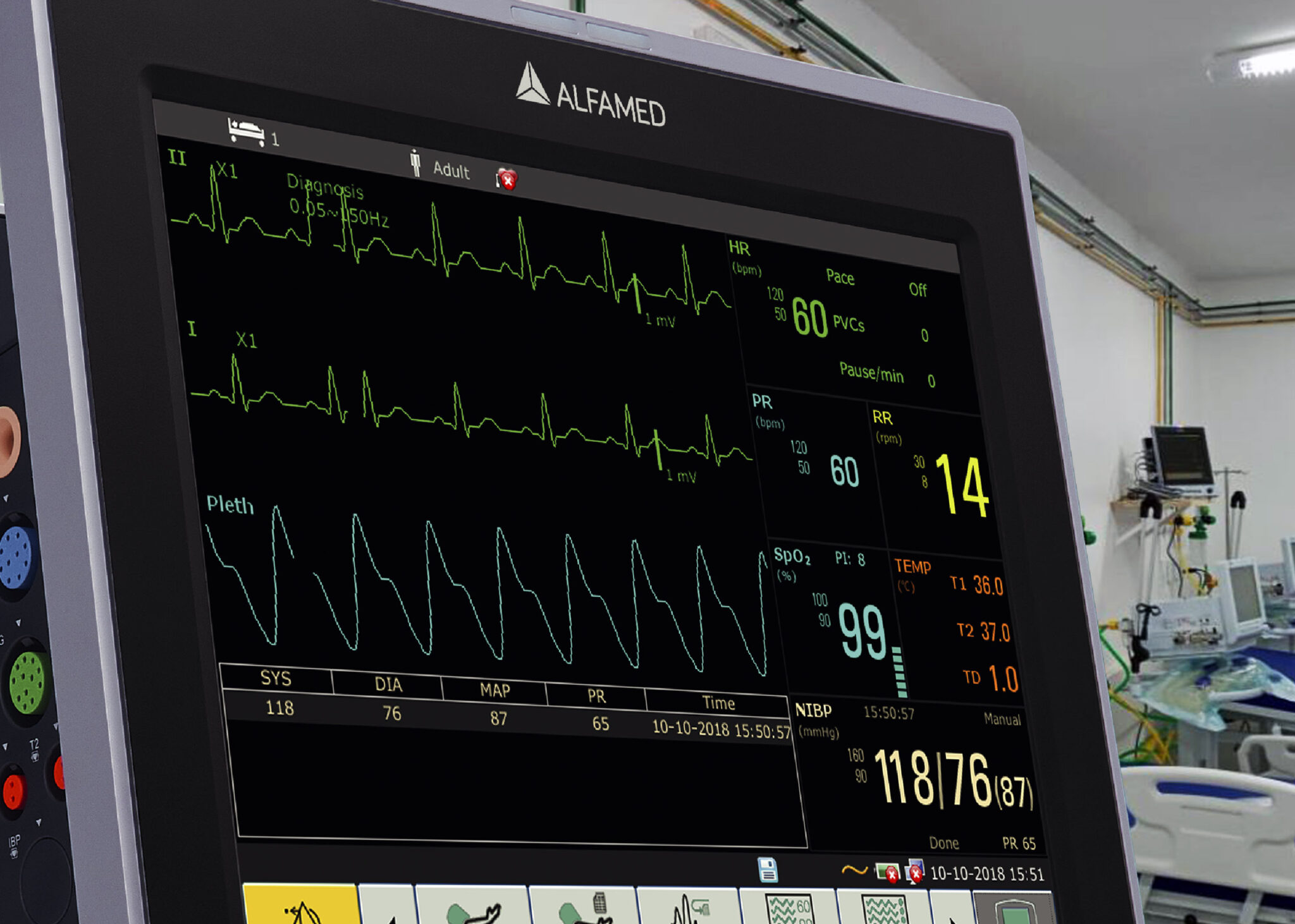 Monitores Hospitalares Alfamed Como escolher o ideal para seu hospital